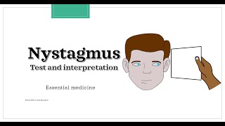 Nystagmus  test and interpretation Essential medicine [upl. by Tormoria]