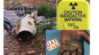 the Goiania Cesium 137 radiological accident [upl. by Rebeh]