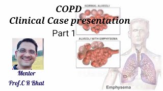 COPD Part 1 [upl. by Romilda]