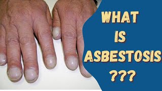 Asbestosis Asbestos disease Sign amp Symptoms Causes and risks [upl. by Jovitta]