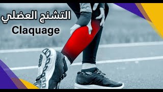 التشنج العضلي اسبابه وعلاجه مع الدكتورة حسناء Claquage [upl. by Nomihs106]