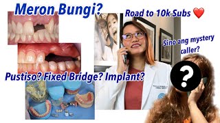 BUNGI PUSTISO FIXED BRIDGE The best for you budget wise  DOC MARA REDIMANO [upl. by Aivatahs677]