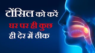 टॉन्सिल्स के घरेलू उपचार Gharelu Upchar for Tonsils in Hindi  Tonsil Home Remedies [upl. by Budworth173]