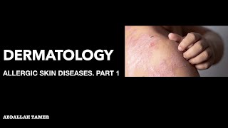 ECZEMA  CONTACT DERMATITIS  ATOPIC  OTHERS QUICK REVIEW بالعربي [upl. by Amak]