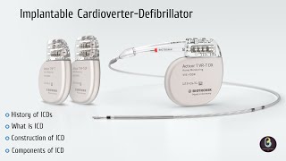 Implantable Cardioverter Defibrillator  ICD  Biomedical Engineers TV [upl. by Haldeman]