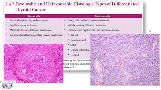 Thyroid carcinoma I Pathology evaluation [upl. by Borg]