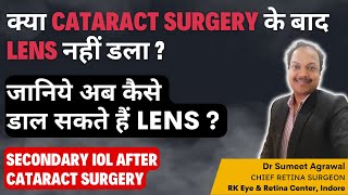 मोतियाबिंद operation के बाद क्या LENS नहीं डल पाया  अब कैसे डलेगा LENS जानिये इसके लिए OPTIONS [upl. by Allred]