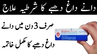 Betaderm Cream For Acne  Acne Treatment  Dane Khatam Karne Ka Tarika  Garmi Dano Ka Ilaj [upl. by Bacon846]