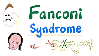 Fanconi Syndrome  Renal Proximal convoluted tubule defect  RTA  Pathology [upl. by Godfry]