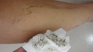 In 5 Minutes Remove Unwanted Body Hair Permanently NO SHAVE NO WAX From First Use Hair Removal [upl. by Maggi]