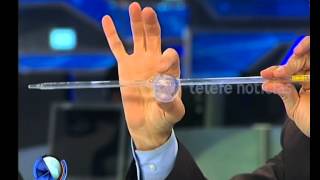 Qué es el aneurisma  Telefe Noticias [upl. by Pirzada675]