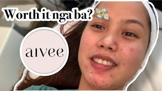 How I got rid of my pimples  AIVEE CLINIC EXPERIENCE  Worth it nga ba [upl. by Neirrad]