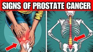 8 Warning Signs of PROSTRATE CANCER You Cant Ignore [upl. by Latrina]