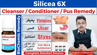 Silicea 6x Homeopathic Medicine Benefits  Silicea Homeopathic Medicine  Silicea [upl. by Ainna599]