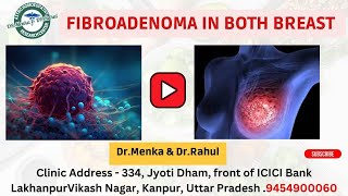 Treatment of Fibroadenoma in Both Breasts breast breastcancer drrahulbabaji drmenka8055 [upl. by Cranford]