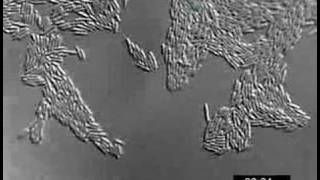 Pseudomonas aeruginosa twitching motility YFPPilU [upl. by Fraser]