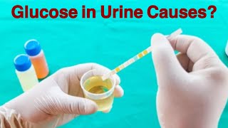 Glucose in urine Causes [upl. by Elokcin]