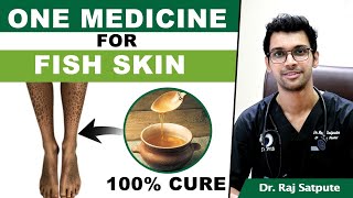 One Medicine To Cure Ichthyosis Vulgaris FISH SKIN  How to Cure FISH SKIN Naturally amp Permanently [upl. by Arvad20]