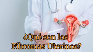 ¿Qué son los Fibromas Uterinos [upl. by Reivax]