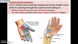 Overview of UL 14  Deep Fascia of Palm of the Hand  Dr Ahmed Farid [upl. by Ilatfan]