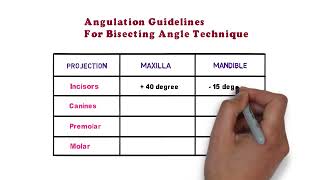 Angulations for IOPA Bisecting Angle technique  RADIOSHOW  Dr Deeksha Sharma [upl. by Elsworth]