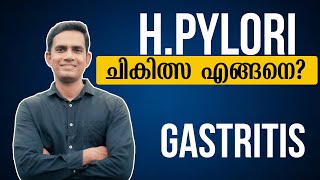 Hpylori ചികിത്സ എങ്ങനെ  Dr Sijil K S [upl. by Angelica]