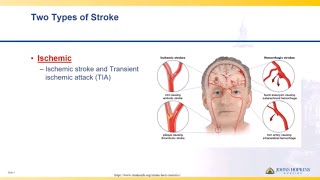 Ischemic Stroke  Lisa Klein [upl. by Ydnir]