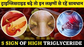 Triglyceride Badhne Se Kya Hota Hai In Hindi  High Triglyceride Sign amp Symptoms  Dr Azhar Mukhtar [upl. by Nuahsyd]