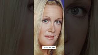 Worst plastic surgery fails celebrities facts foryou [upl. by Retrop42]