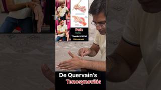 De Quervains tenosynovitis Rehab  De Quervains tenosynovitis Exercises [upl. by Coady]