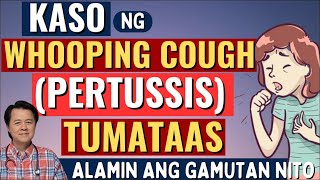 Kaso ng Whooping Cough Tumataas Alamin ang Gamutan Tips By Doc Willie Ong [upl. by Alliscirp]