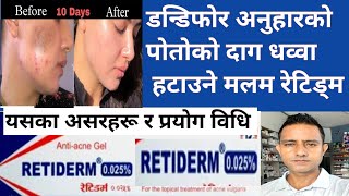 Retidrem 025tretinoin in Nepali।डन्डिफोरको दाग अनुहारको कालो चायाॅं पोतो हटाउने मलमacne [upl. by Notsle]