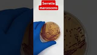 Serratia marcescens On meconky Agar microbiology [upl. by Bomke]