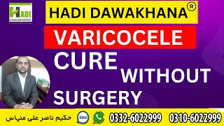 Varicocele Causes Symptoms Treatment in urdu  Hindi What is Varicocele  Varicocele ka desi ilaj [upl. by Nnylarej]