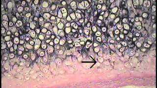 Cartilage and Bone Histology FreeMedEd [upl. by Auqinehs]