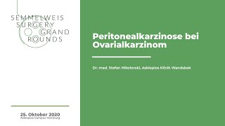 Peritonealkarzinose bei Ovarialkarzinom  Dr med Stefan Nikolovski [upl. by Nref]