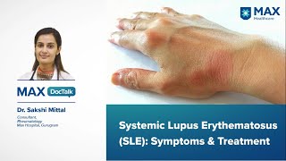 Systemic Lupus Erythematosus SLE Symptoms amp Treatment  Dr Sakshi Mittal  Max Gurugram [upl. by Anpas]