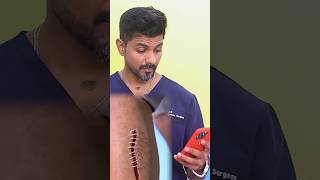 Dr Charan Reacts to AtHome Suture System Zip Stitch Safe or Scam glowwithdrcharan aesthetiq [upl. by Mathi115]