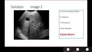 Radio  Limagerie du foie pancréas et voies biliaires [upl. by Dnumde]