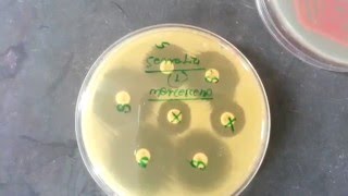 Serratia marcescens [upl. by Marmawke]