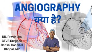 What is Angiography  Angiography kab karwayen  Dr Pravir Jha [upl. by Skelton]