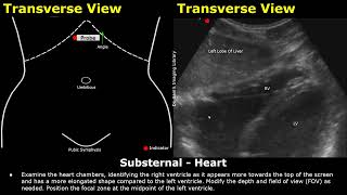 FAST Ultrasound Scan Probe Positioning  Transducer Placement USG  ChestSubsternalRUQLUQ Views [upl. by Aceissej]