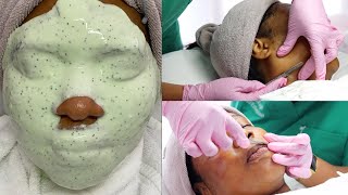 Watch  Full Dermaplaning Facial Treatment [upl. by Annaor]