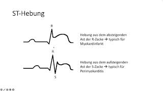 Klinische Skills 2 EKG Befundung Grundlagen [upl. by Yffub]