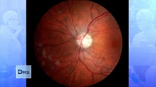 How COVID19 amp Other Illnesses Can Affect Your Eyesight [upl. by Schaper]