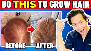 How to Treat Thinning Hair The Holistic Way [upl. by Eerahc]