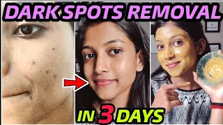 In 7 DAYS  Remove DARK SPOTS ACNE SCARS PIMPLE MARKS amp PIGMENTATION in JUST 7 DAYS  100 RESULTS [upl. by Wilber777]