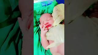 Newborn afterbirth videoNursing care of Newborntrendingviralshort [upl. by Nyvrem]