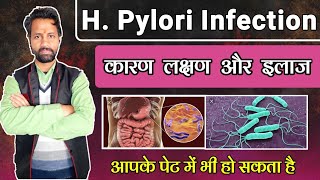 h pylori infection in hindi  H PYLORI क्यों है खतरनाक   IS H PYLORI CONTAGEOUS [upl. by Eerot]