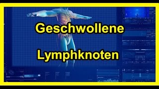 Geschwollene Lymphknoten  Vergrößerte Lymphknoten 2020 [upl. by Leone]